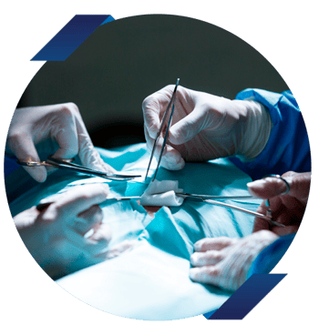 Cirugía Argentina - Complicaciones en la cirugía bariátrica